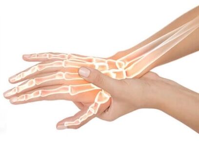 Hondrox sa aplikuje na postihnutú oblasť