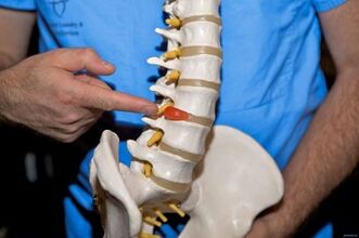 Prečo bolí chrbát v dolnej časti chrbta a čo robiť