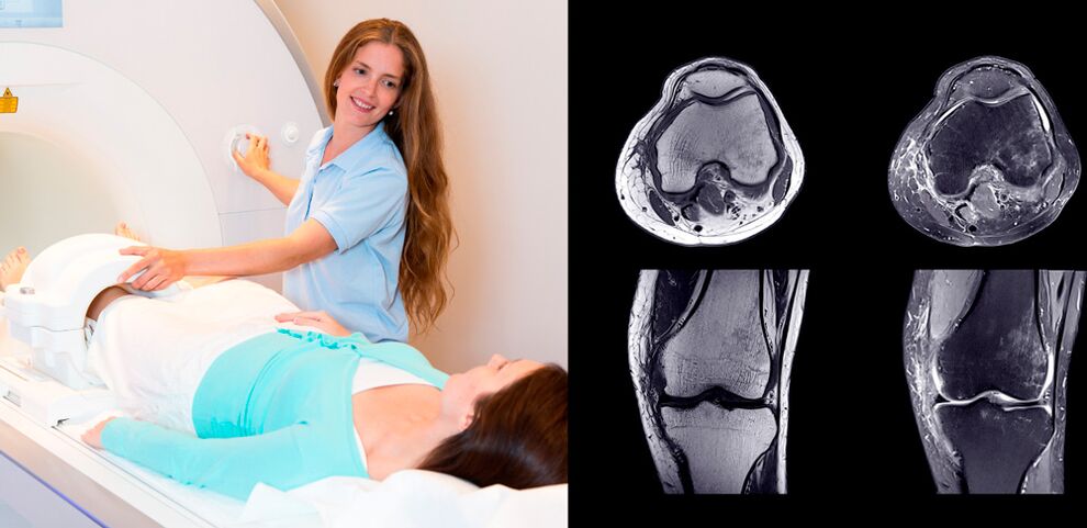 diagnostika kolenného kĺbu