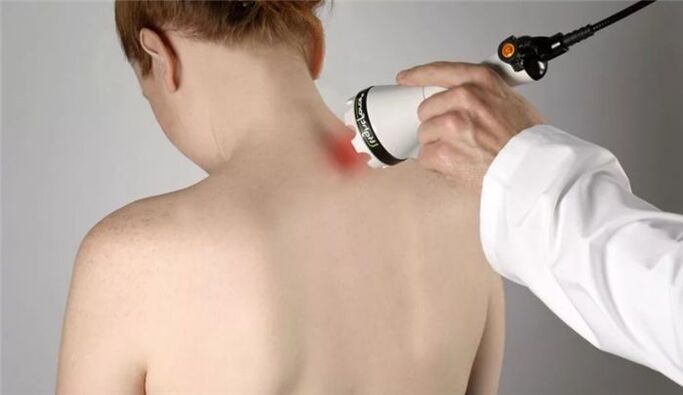 fyzioterapia na liečbu cervikálnej osteochondrózy