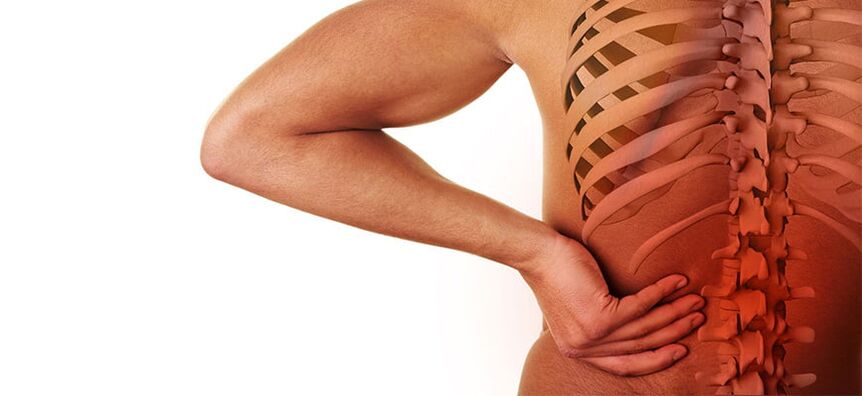 príznaky bedrovej osteochondrózy